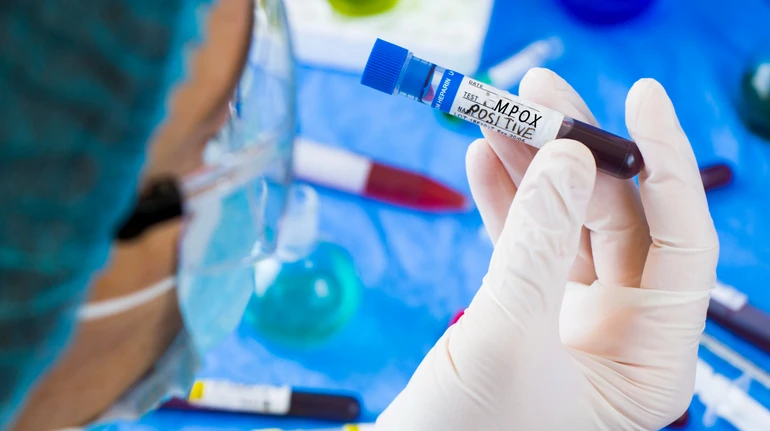 Загрозливе поширення мутованого штаму мавпячої віспи в європейських країнах: тривожні сигнали для систем охорони здоров’я